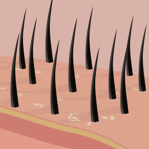 Buy 1 Ketoconazole Dandruff Shampoo (150ml) Bodywise